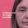 Lifting Facial Sin Cirugía (Cita de Evaluación)