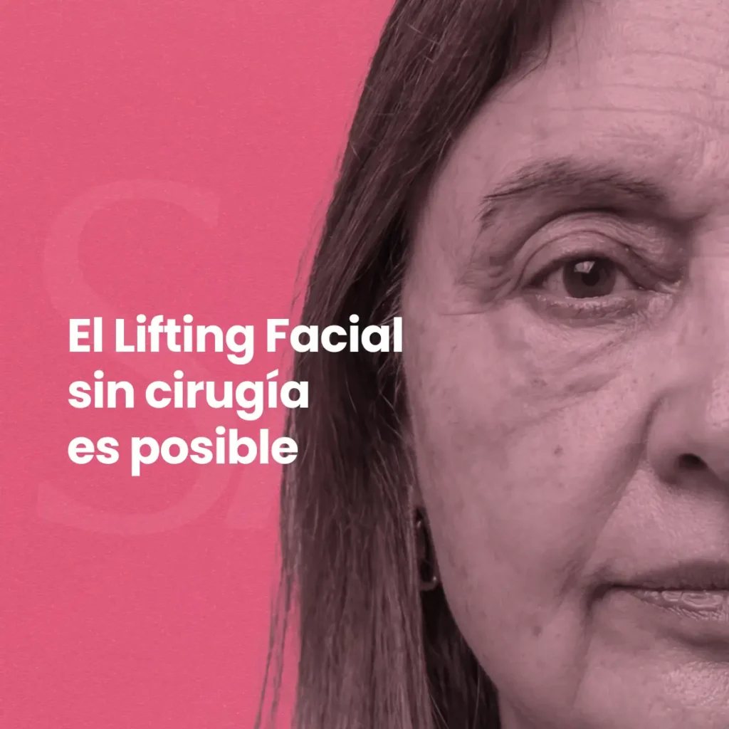Lifting Facial Sin Cirugía (Cita de Evaluación)