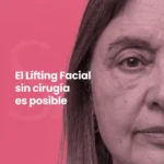 Lifting Facial Sin Cirugía (Cita de Evaluación)