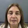 Lifting Facial Sin Cirugía (Cita de Evaluación)
