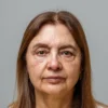 Lifting Facial Sin Cirugía (Cita de Evaluación)
