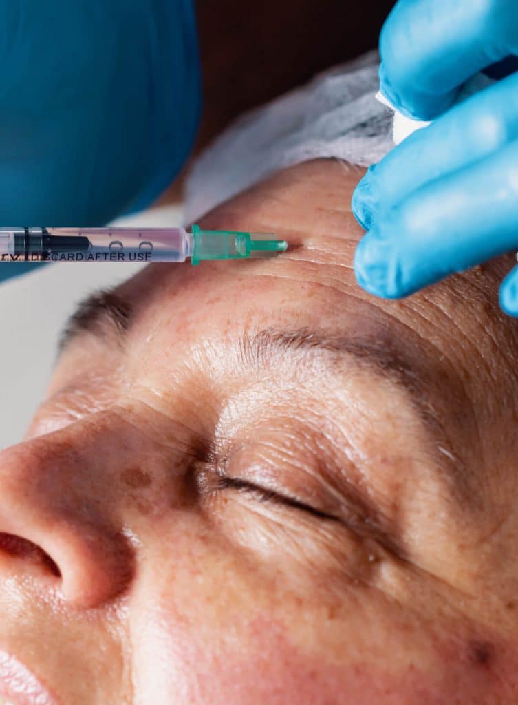 Inyectando a paciente Botox (Tóxina Botulínica)