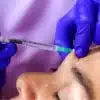 Sculptra+ Toxina Botulinica+ Regalo